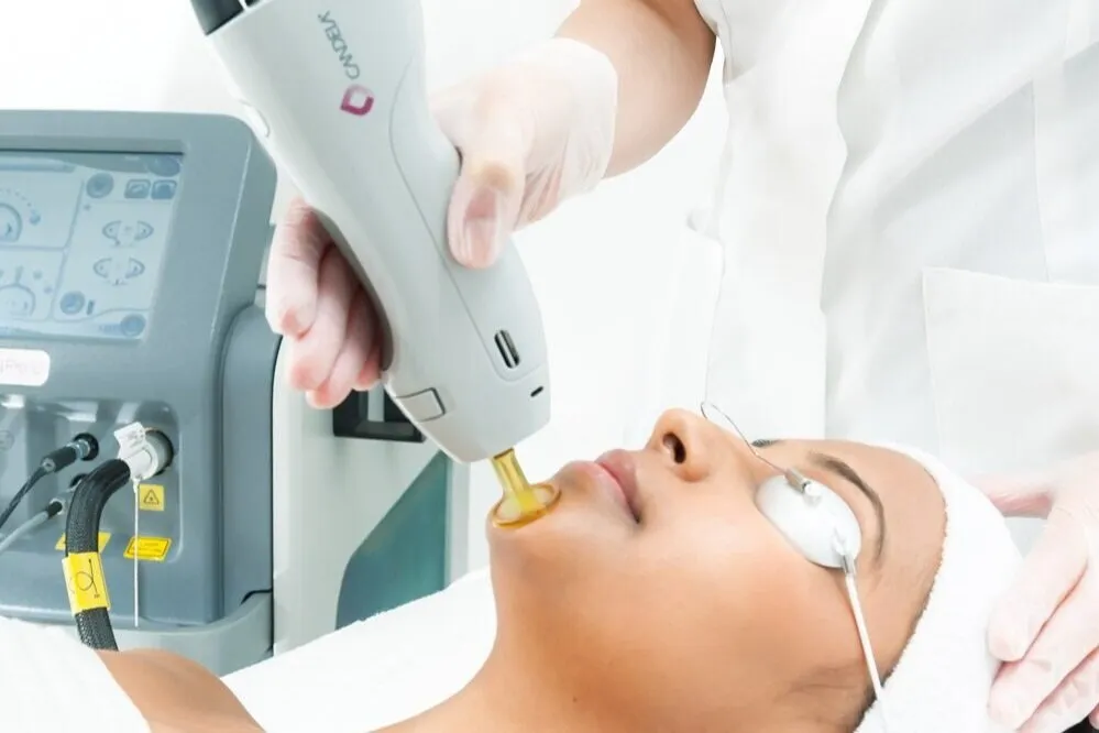 hair laser removal
