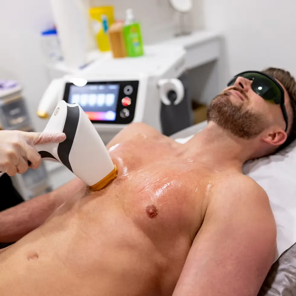 hair laser removal