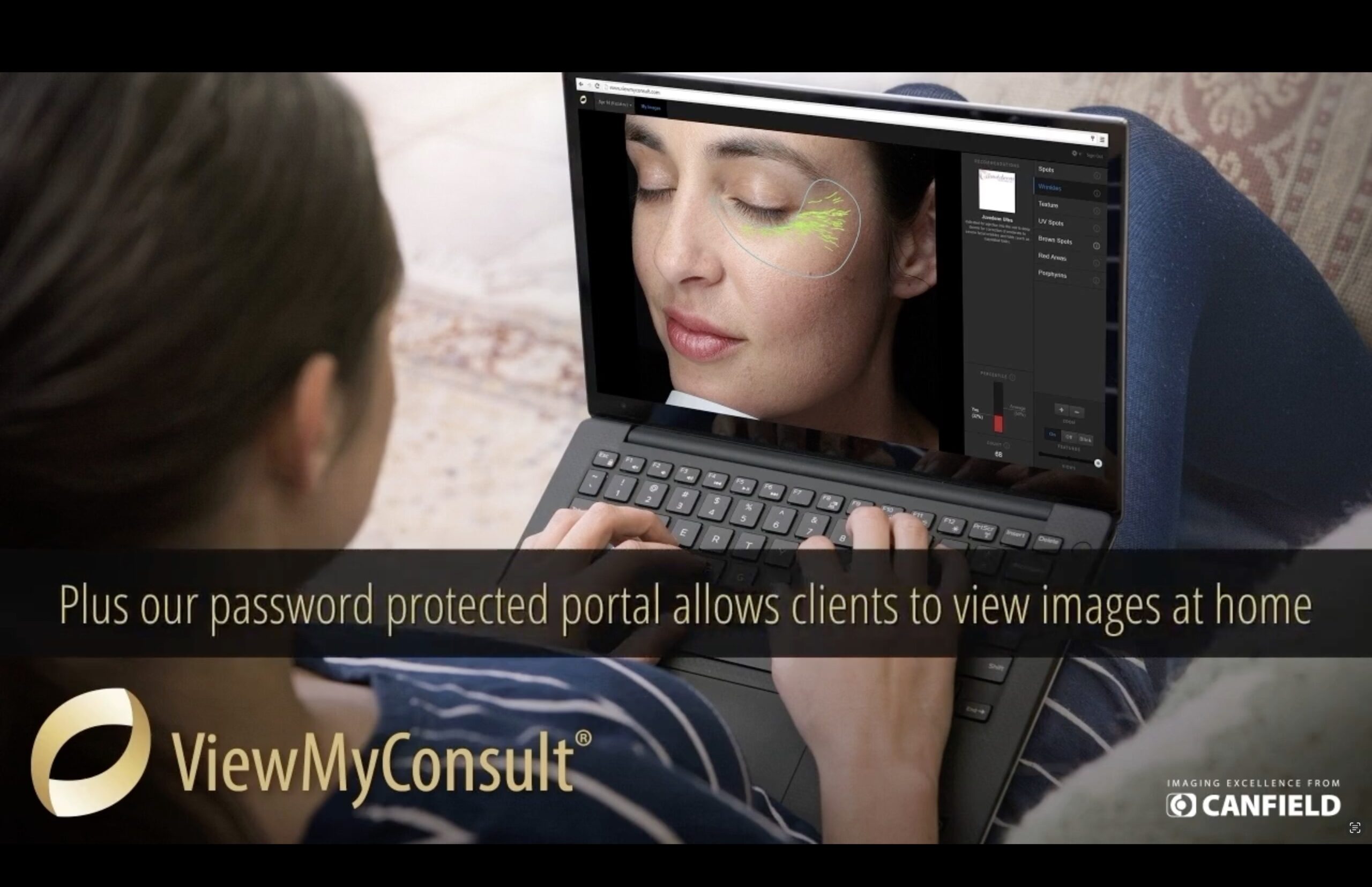 VISIA® Skin Analysis
