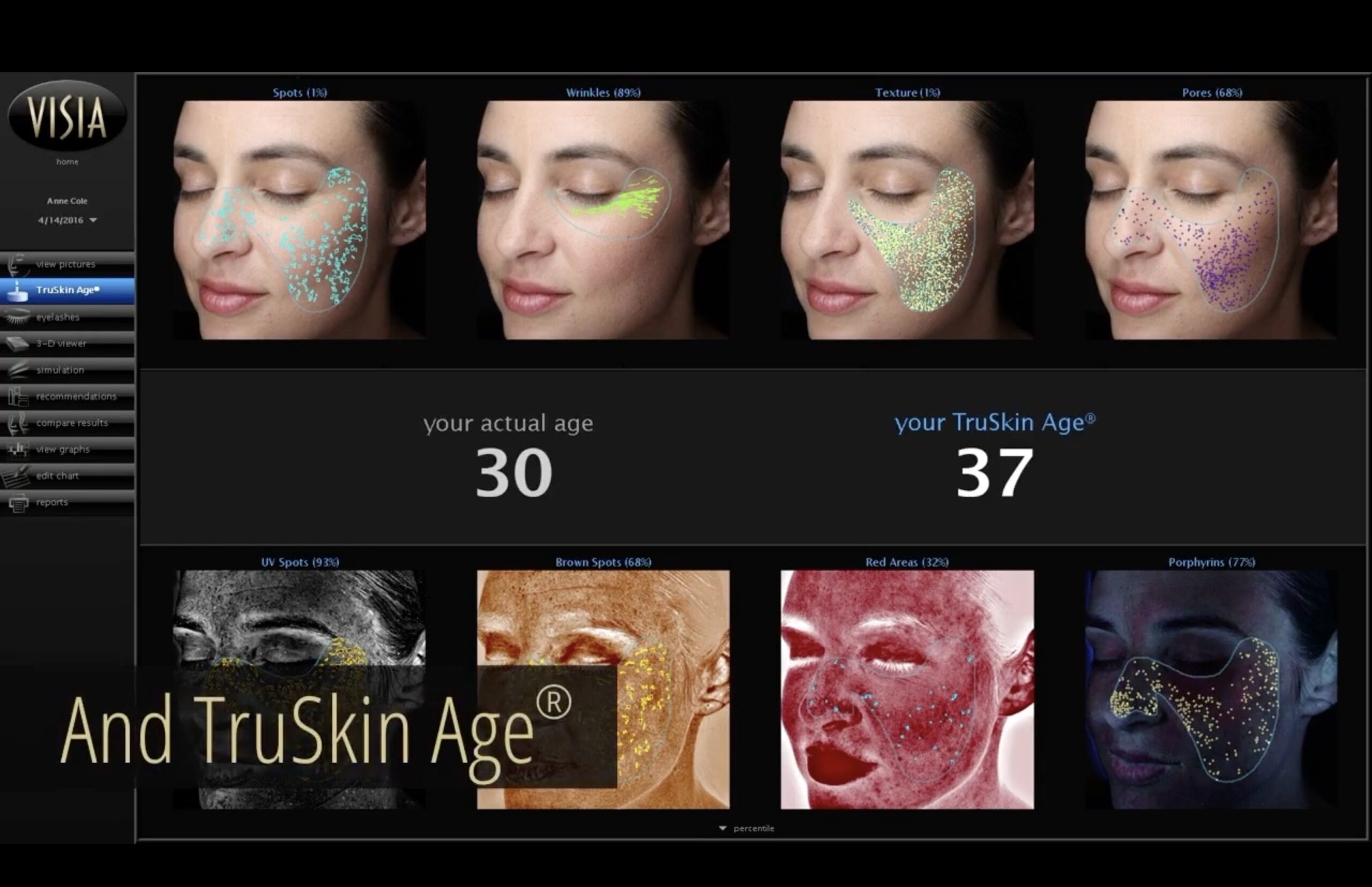 VISIA® Skin Analysis work