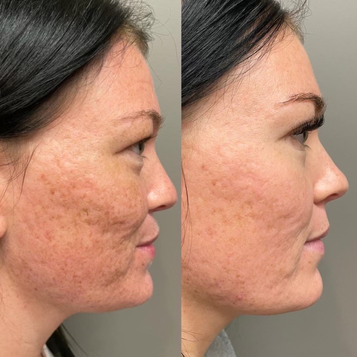 Before and after
