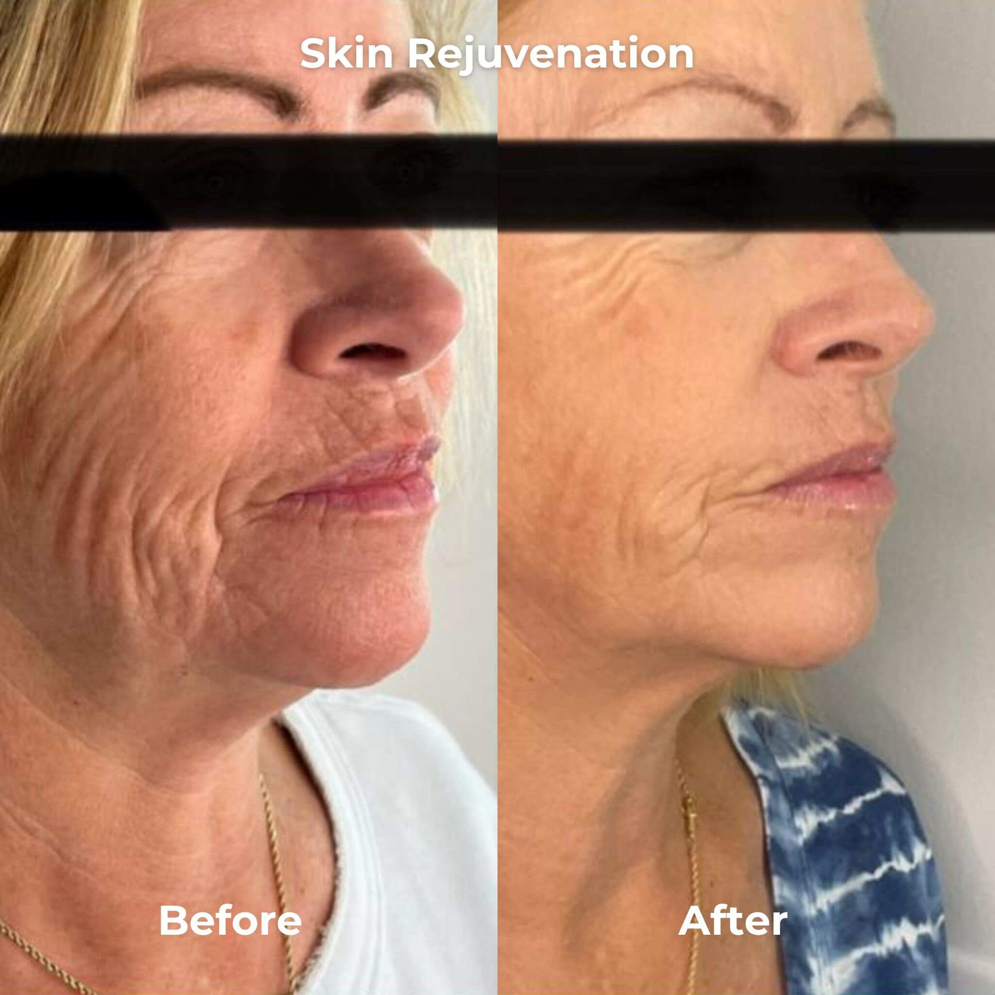 before and after
