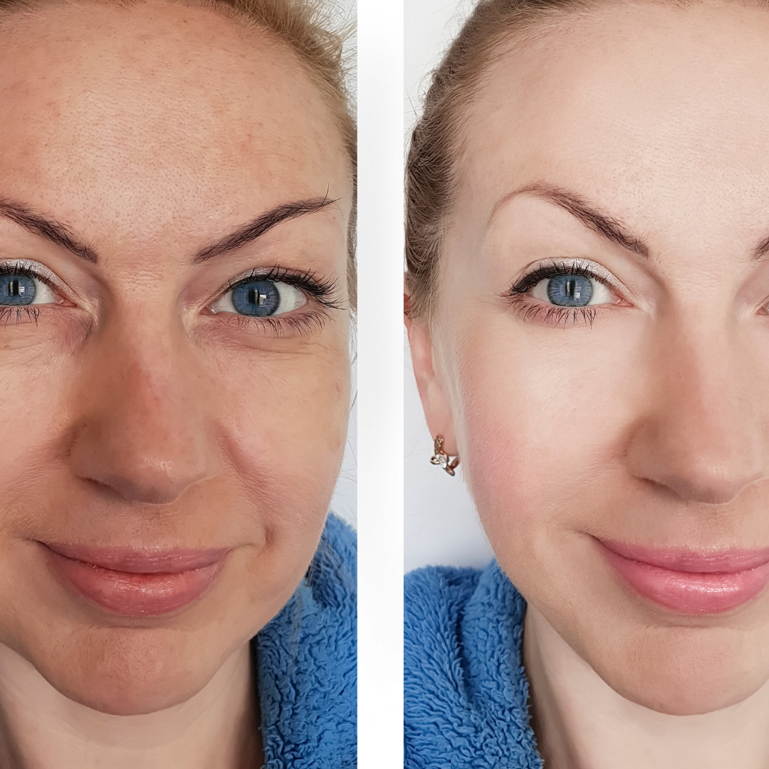 before and after