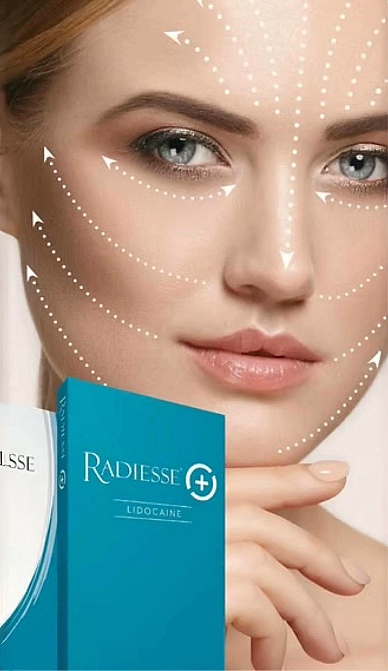 Radiesse