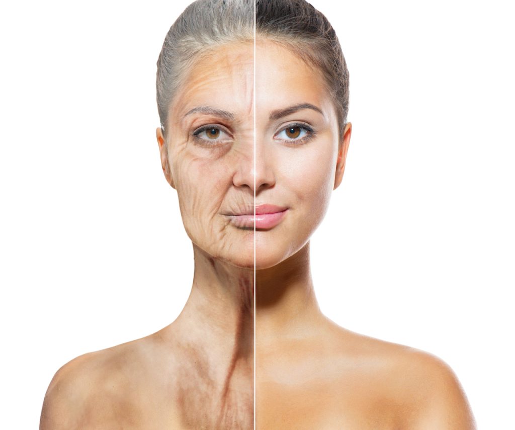 Before and After Image: Anti-Aging Medicine - front