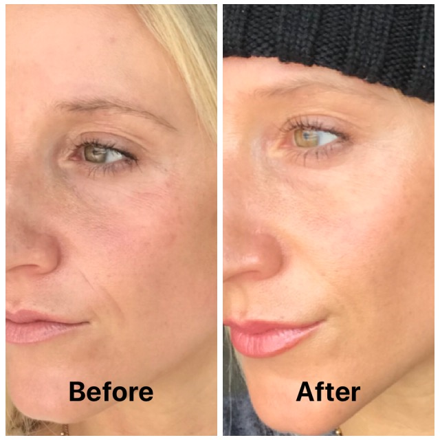 Before and After Image: Clear + Brilliant - left-front-oblique