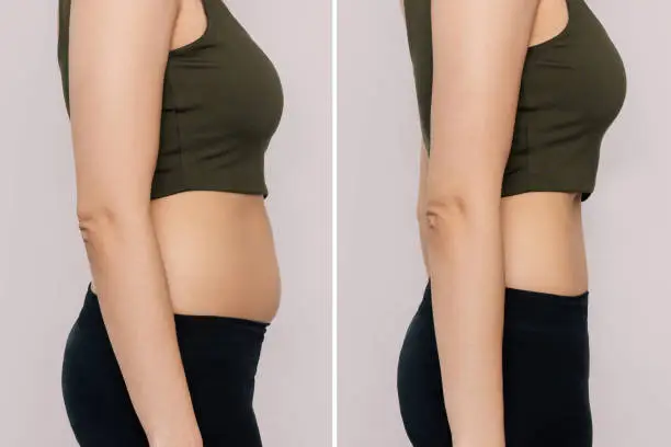 Before and After Image: Emsculpt Neo - right-side